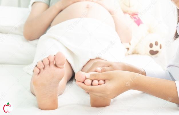 ورم پا در بارداری سیوطب 