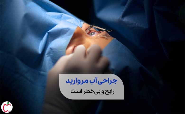 پزشک در حال جراحی آب مروارید|سیوطب