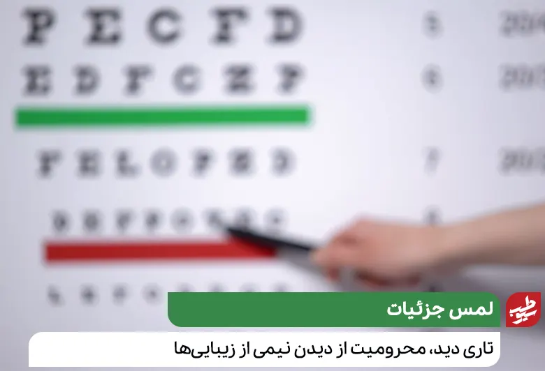 درمان تاری دید و شناسایی آن با علائم سنجش بینایی|سیوطب