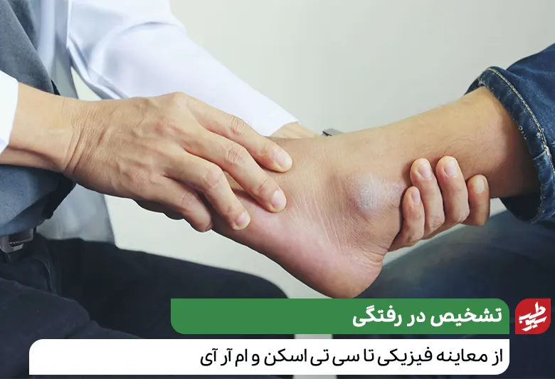 پزشک در حال معاینه مچ پای بیمار برای درمان در رفتگی مچ پا|سیوطب