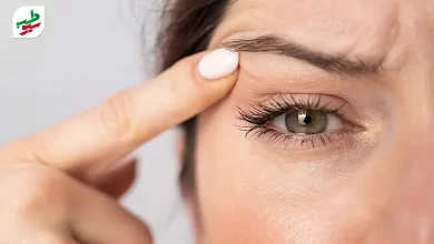 درمان پرش پلک چشم|سیوطب
