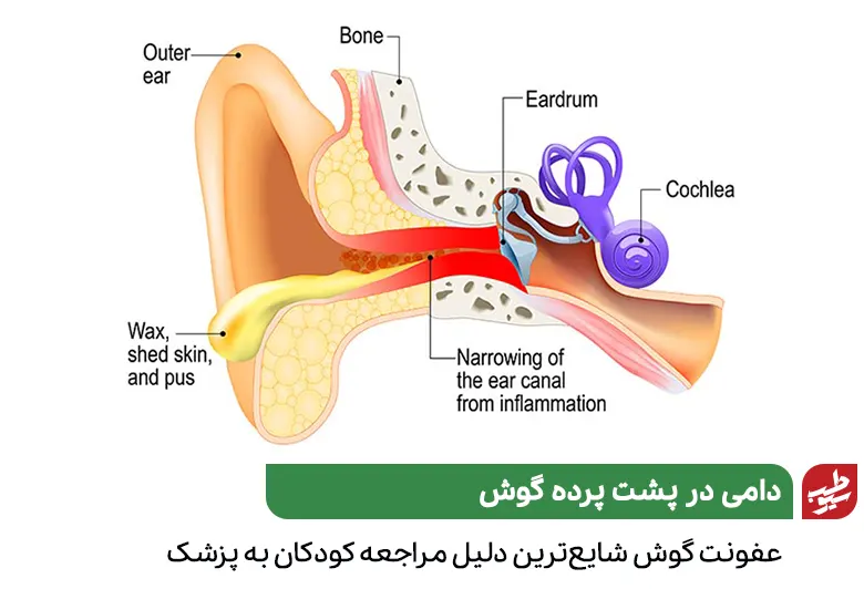 آناتومی گوش که نیاز به درمان عفونت گوش دارد|سیوطب