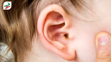 گوشی که نیاز به درمان عفونت گوش دارد|سیوطب