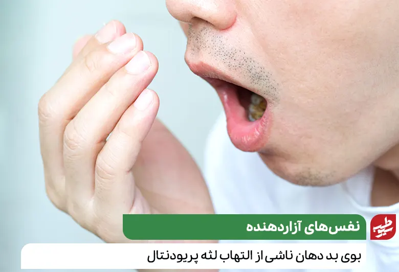 فردی که به علت تورم لثه دهانش بوی بد می‌دهد و نیاز به درمان التهاب لثه دارد|سیوطب