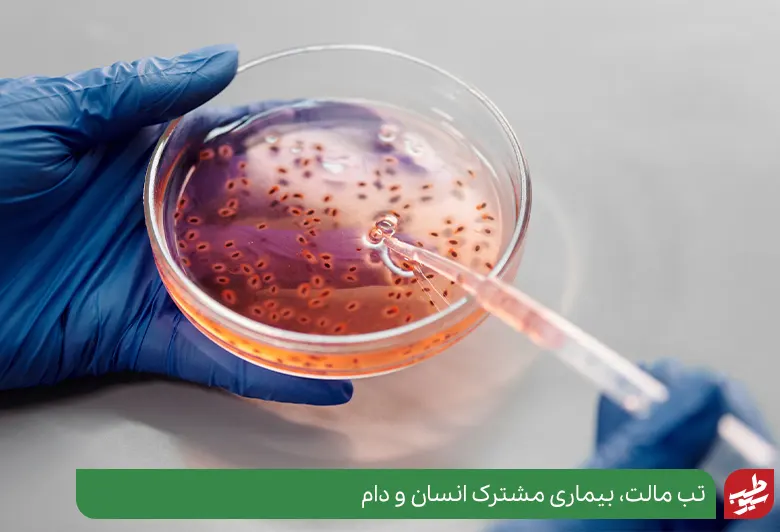 علائم تب مالت در بزرگسالان در اثر انتقال باکتری بروسلا از مواد خوراکی دامی آلوده ایجاد می‌شود|سیوطب