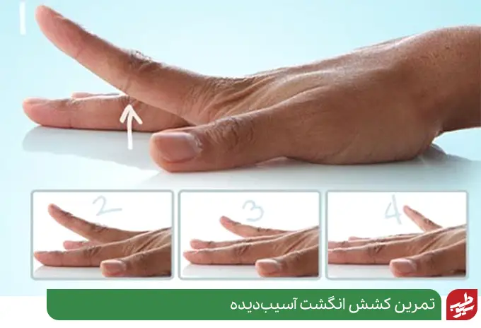تمرین کشش انگشت برای بهبود انگشت ماشه ای|سیوطب