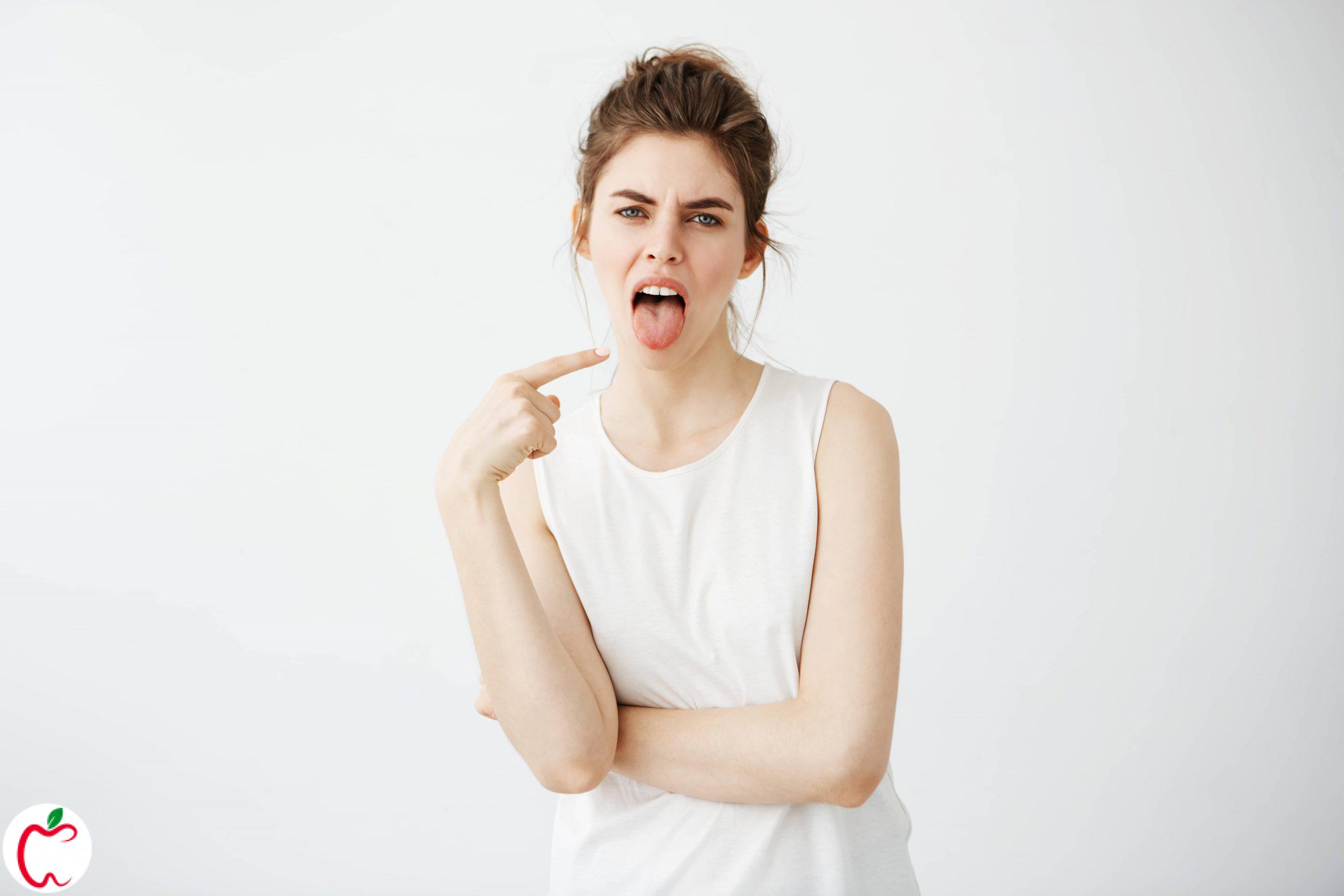 درمان خانگی سفیدی زبان سیو طب 