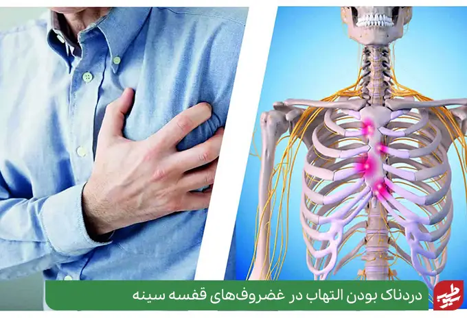 بیماری التهابی در غضروف‌ها باعث درد قفسه سینه سمت راست می‌شود|سیوطب