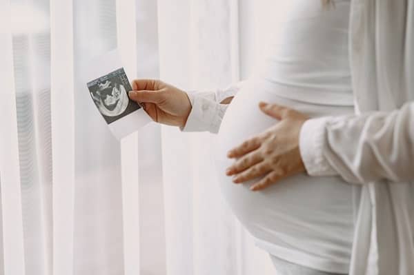 زن باردار با لباس سفید و عکس سونوگرافی به دست | کم تحرکی زنان باردار | سیوطب
