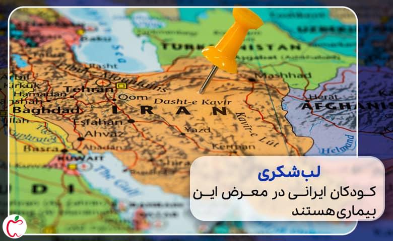 نقشه ایران |  جراحی لب شکری