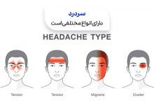 محل های مختلف بروز سردرد روی سر یک انسان سیوطب