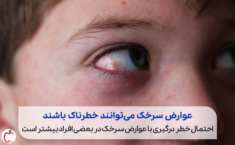 یک چشم آلوده به عفونت که از عوارض سرخک است (کونژنکتیویت)| سیوطب