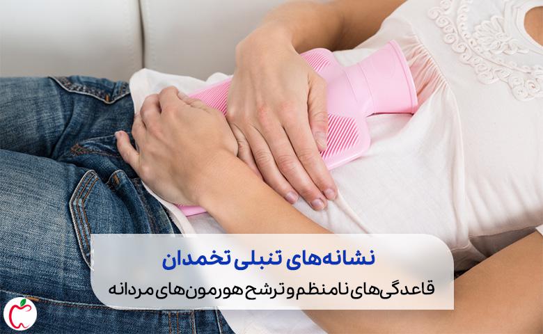 در بیماری تنبلی تخمدان یا سندرم تخمدان پلی کیستیک، تخمک‌گذاری انجام نمی‌شود|سیوطب
