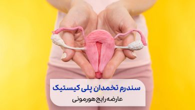 تنبلی تخمدان، یک عارضه رایج هورمونی برای خانم‌های در سن باروری است. |سیوطب