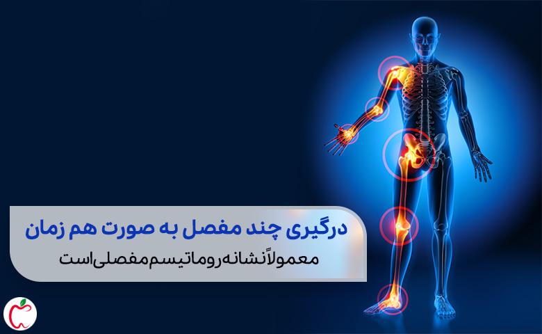 بدن انسان که مناطق آسیب پذیر در روماتیسم مفصلی مانند مفاصل دست، مچ و زانو در آن مشخص شده اند|سیوطب