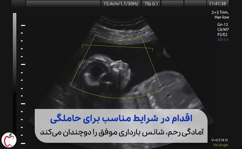 تصویر سونوگرافی رحم برای بررسی آمادگی رحم برای بارداری |سیوطب