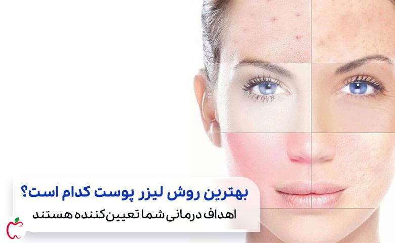 انواع مختلف مشکلات پوستی که با لیزر پوست درمان می‌شوند| سیوطب
