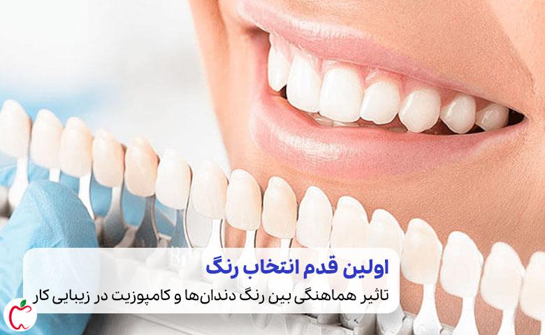 انتخاب رنگ کامپوزیت دندان برای هماهنگی بیشتر با دندان‌ها| سیوطب