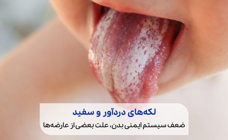 درمان خارش دهان کودکان به دلیل برفک کاری مهم و ساده است|سیو طب