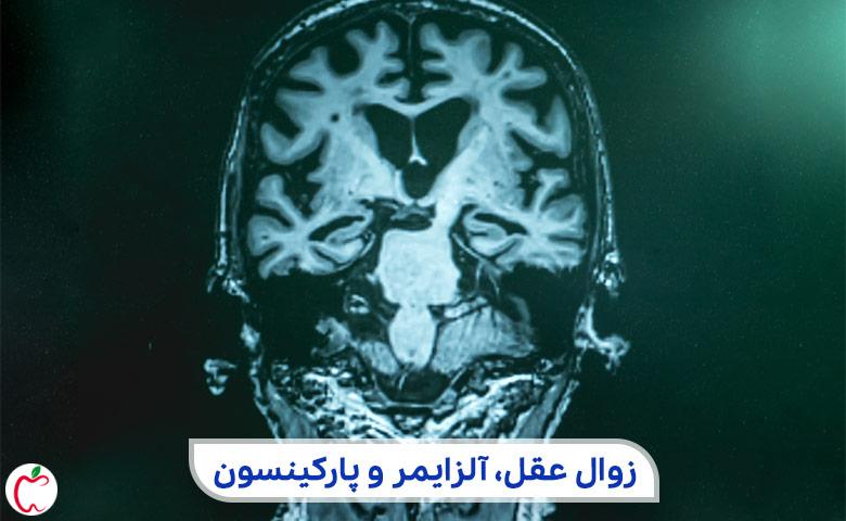 بیماری زوال عقل در بیماری‌‌ های شایع سالمندان|سیوطب