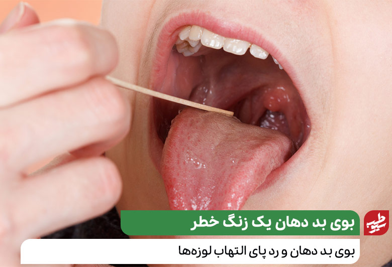 علت بوی بد دهان کودکان به دلیل خشکی دهان|سیوطب