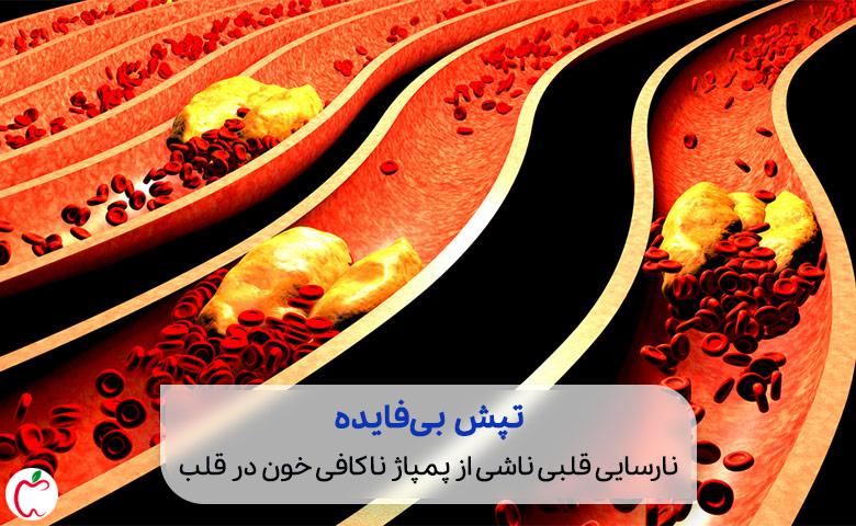 وکتور عدم پمپاژ خون در قلب|سیو طب