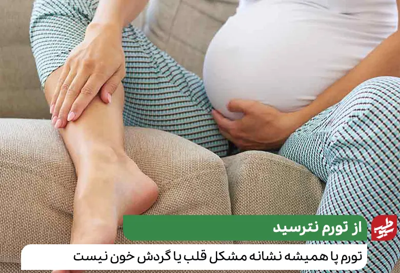 زن بارداری با ورم ساق پا|سیوطب