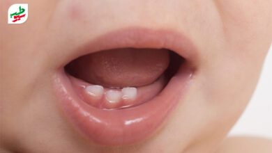 علت بوی بد دهان کودکان و مراجعه به پزشک|سیوطب