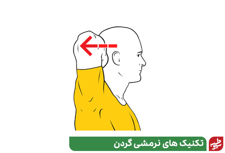 ورزش گردن درد با حرکت به جلو و عقب|سیوطب