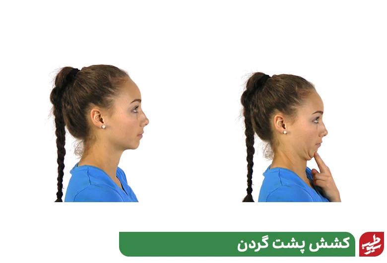 کشش پشت گردن برای ورزش آرتروز گردن|سیوطب