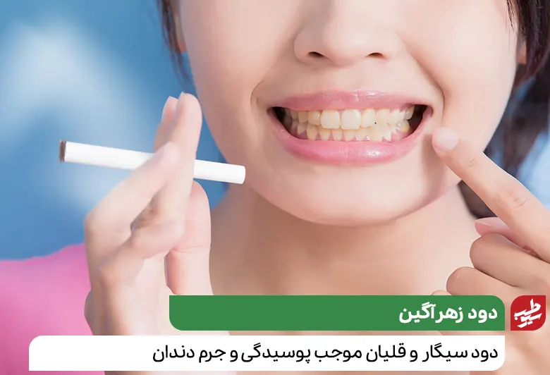 جرم گیری دندان و سیگار کشیدن که باعث زردی و پوسیدگی دندان می‌شود|سیوطب