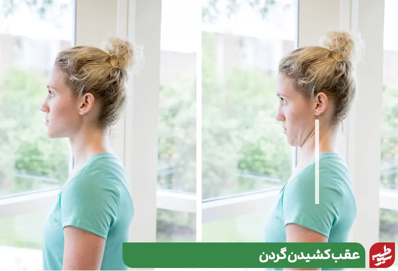 ورزش عقب کشیدن گردن برای درمان فتق دیسک گردن|سیوطب