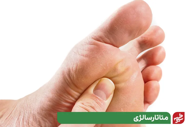 فردی که به متاتارسالژی مبتلاست به تشخیص علت درد کف پا نیاز دارد|سیوطب