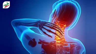 انواع گردن درد و مهره‌هایی از گردن که دچار مشکل هستند|سیوطب