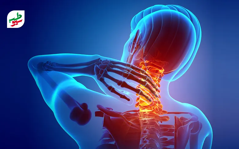 انواع گردن درد و مهره‌هایی از گردن که دچار مشکل هستند|سیوطب