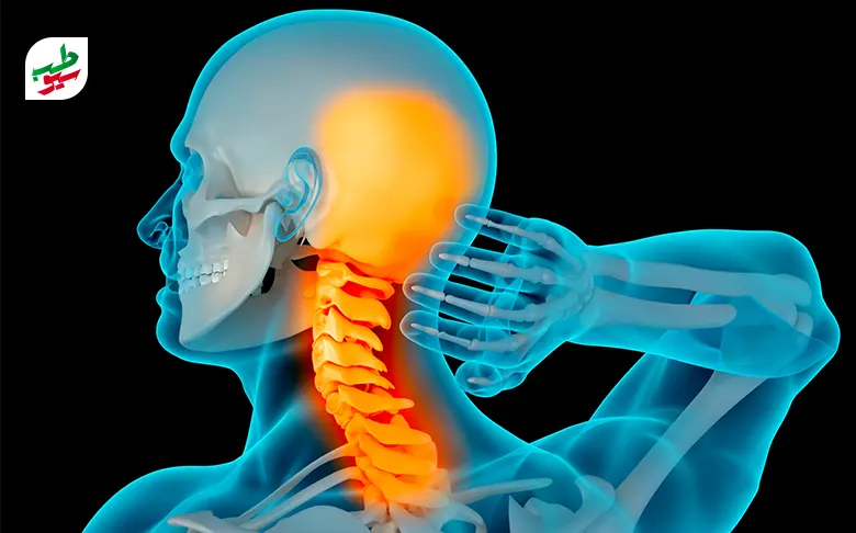 مهره‌های پر تحرک گردن که تحرک زیاد آن‌ها منجر به صدا دادن گردن می‌شوند|سیوطب