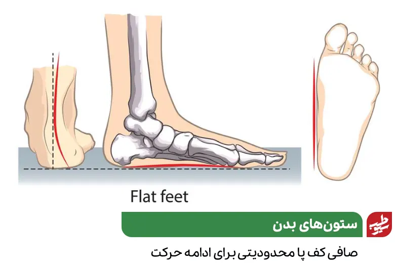 آناتومی پا که نشان دهنده عامل ایجاد صافی کف پا هست|سیوطب