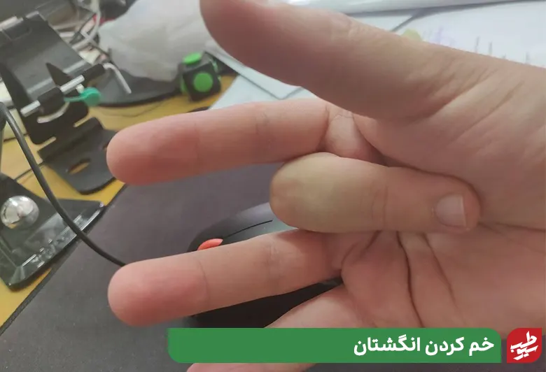 خم کردن انگشتان ورزش دست درد|سیوطب