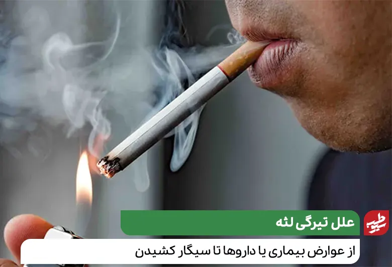 شخصی که به دلیل سیگار کشیدن دچار تیرگی لثه شده است|سیوطب