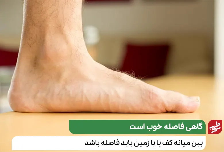 کف پای شخصی که به درمان صافی کف پا نیاز دارد، روی زمین|سیوطب