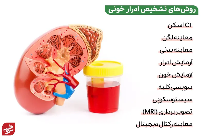 تشخیص ادرار خونی برای درمان آن اهمین بالایی دارد|سیوطب