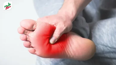 فردی که در ناحیه کف پا احساس درد می کند و به تشخیص صافی کف پا نیاز دارد|سیوطب