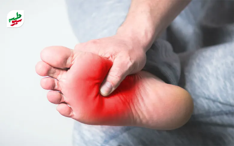 فردی که در ناحیه کف پا احساس درد می کند و به تشخیص صافی کف پا نیاز دارد|سیوطب