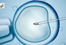 درمان ناباروری به روش IVF به معنی لقاح تخمک و اسپرم در آزمایشگاه است|سیوطب