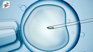 درمان ناباروری به روش IVF به معنی لقاح تخمک و اسپرم در آزمایشگاه است|سیوطب