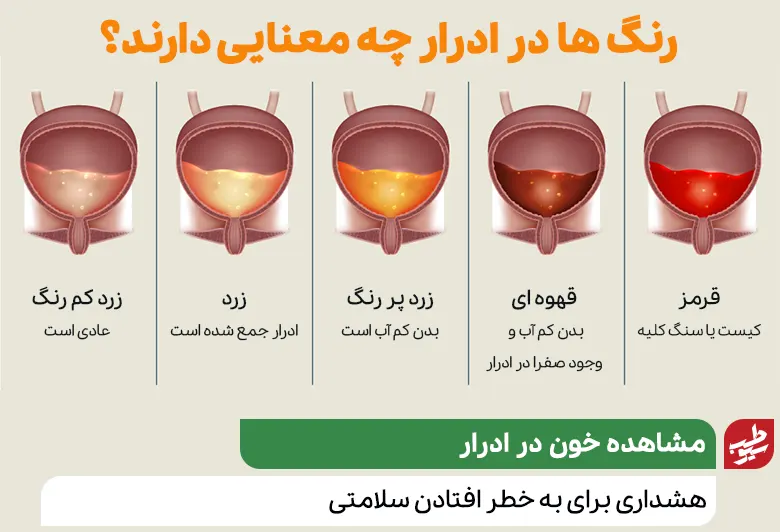 وکتور آناتومی کلیه‌ها و مجاری ادرار انسان برای بررسی علل ادرار خونی|سیوطب