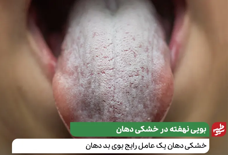 رفع بوی بد دهان در ماه رمضان با از بین بردن خشکی دهان|سیوطب