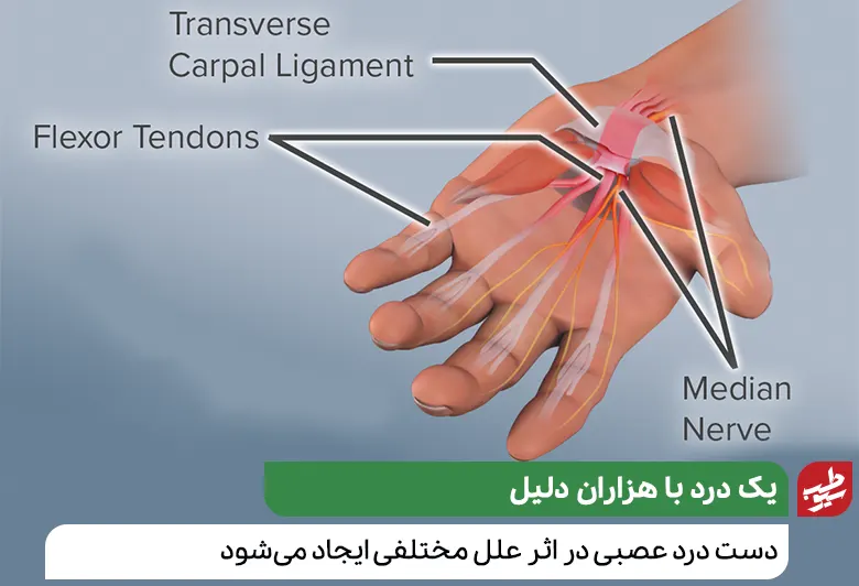 دست درد عصبی در اثر علل مختلفی ایجاد می‌شود|سیوطب