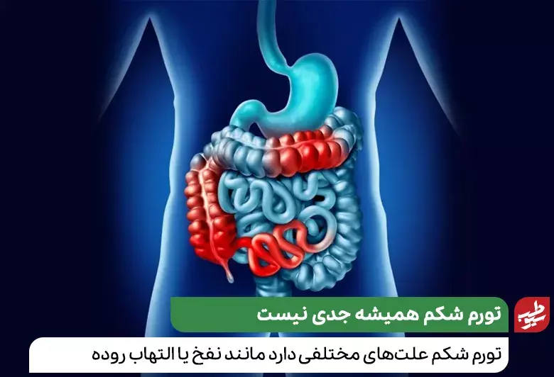 بیماری التهاب روده یک دلیل برای تورم ناحیه شکم است|سیوطب