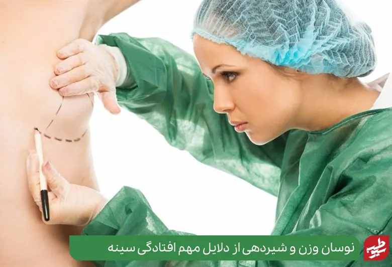 پزشک در حال بررسی پستان یک زن برای جراحی لیفت سینه|سیوطب